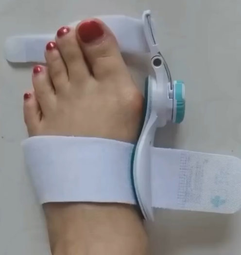 Foot Bunion Corrector